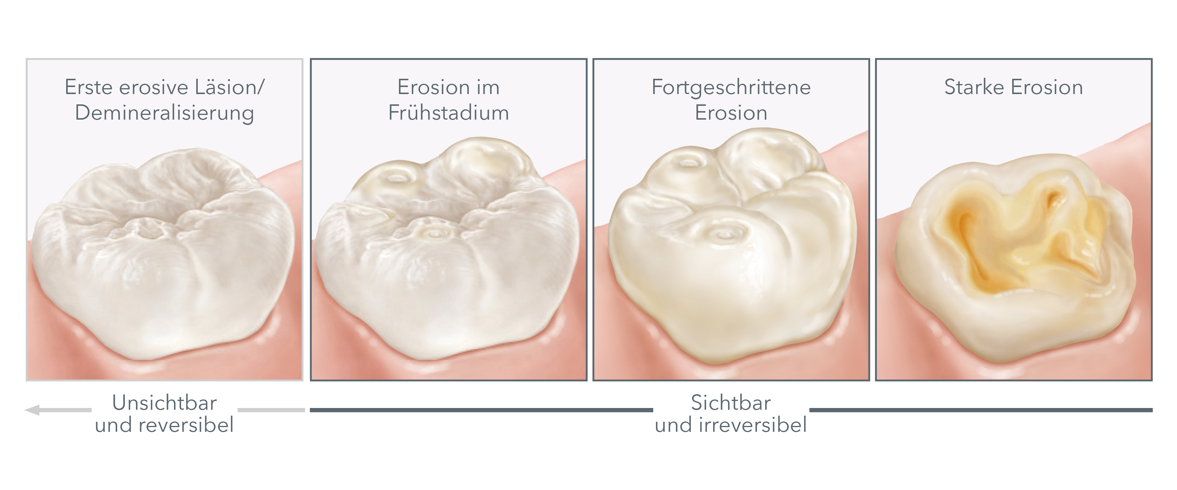 Entstehung, Ursachen und Symptome