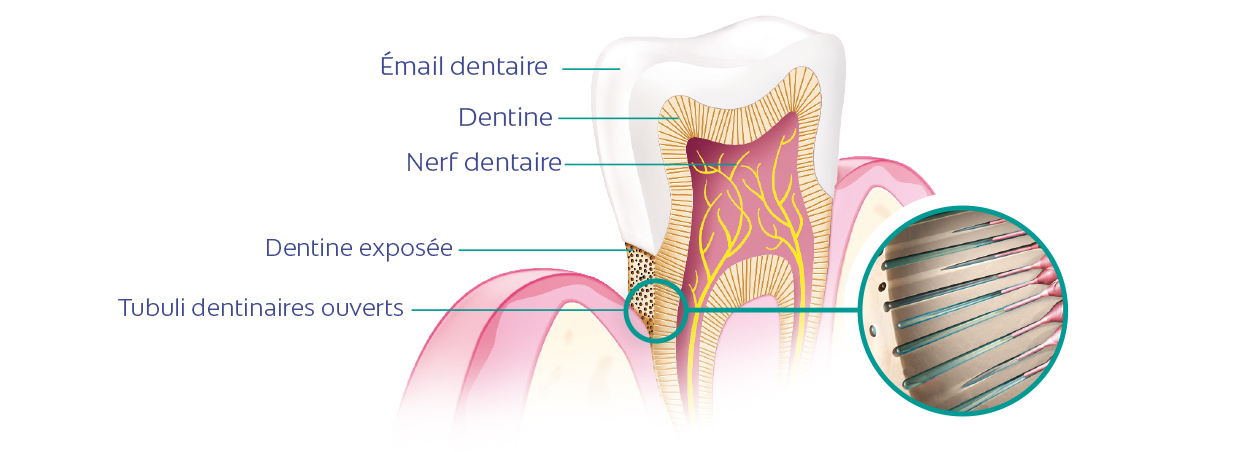 Étiologie, causes et symptômes