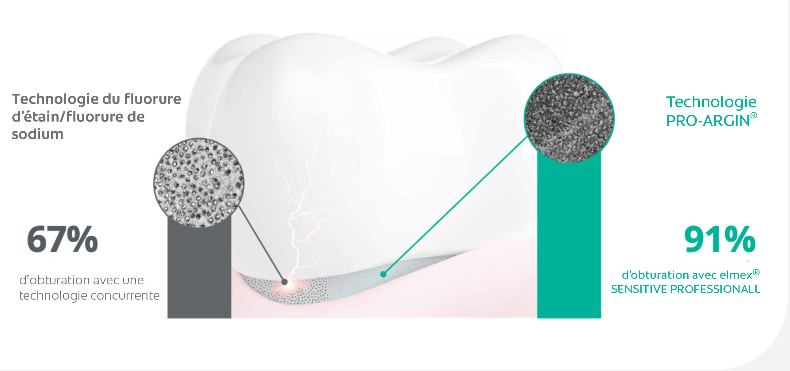elmex® SENSITIVE PROFESSIONAL mit PRO-ARGIN Technologie