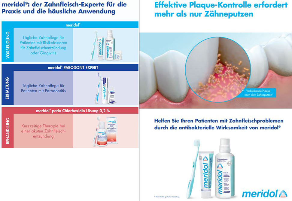 PDF sur la contrôle efficace de la plaque pour les patients ayant des problèmes des gencives