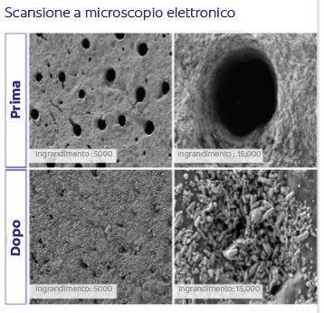 Microscopia elettronica a scansione (SEM)4
