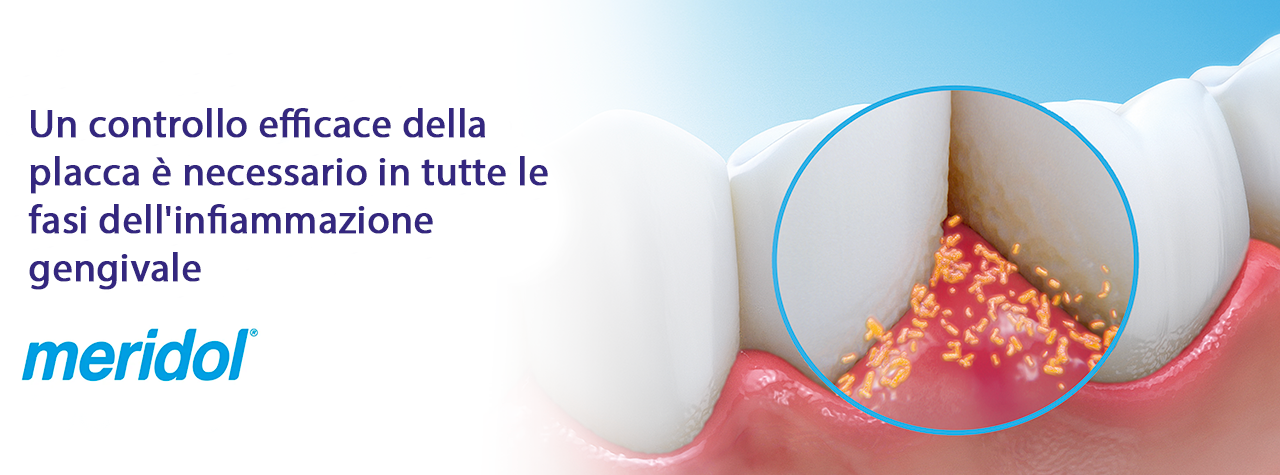 meridol ® - Un controllo efficace della placca